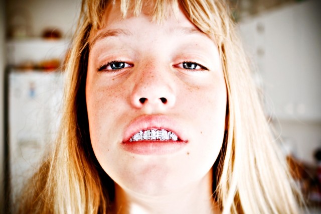 Soon We Will All Have Diamond Teeth, No Grillz Required | The Mary Sue